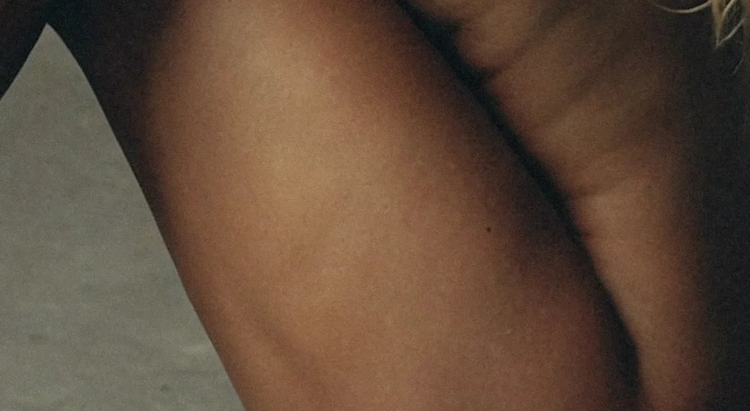 Lipolysis