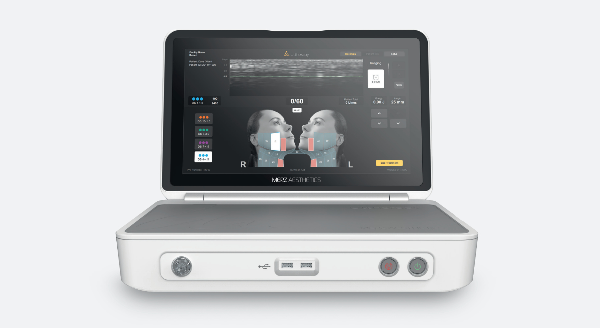 Ultherapy PRIME® Behandlungszonen Gesicht, Hals & Dekolleté