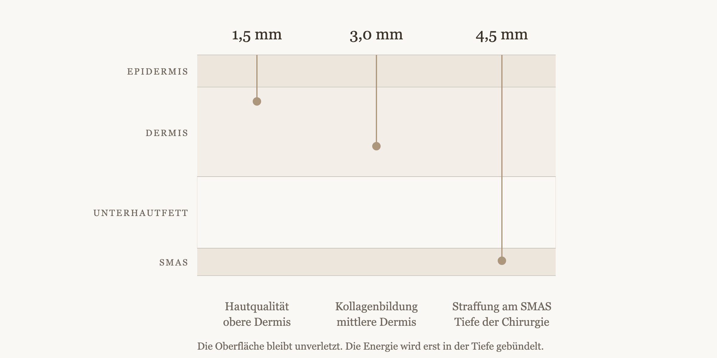 Ultherapy PRIME Berlin: Der Leitfaden | The Retreat 2 Querschnitt der Haut mit den drei Behandlungstiefen 1,5 mm, 3,0 mm und 4,5 mm