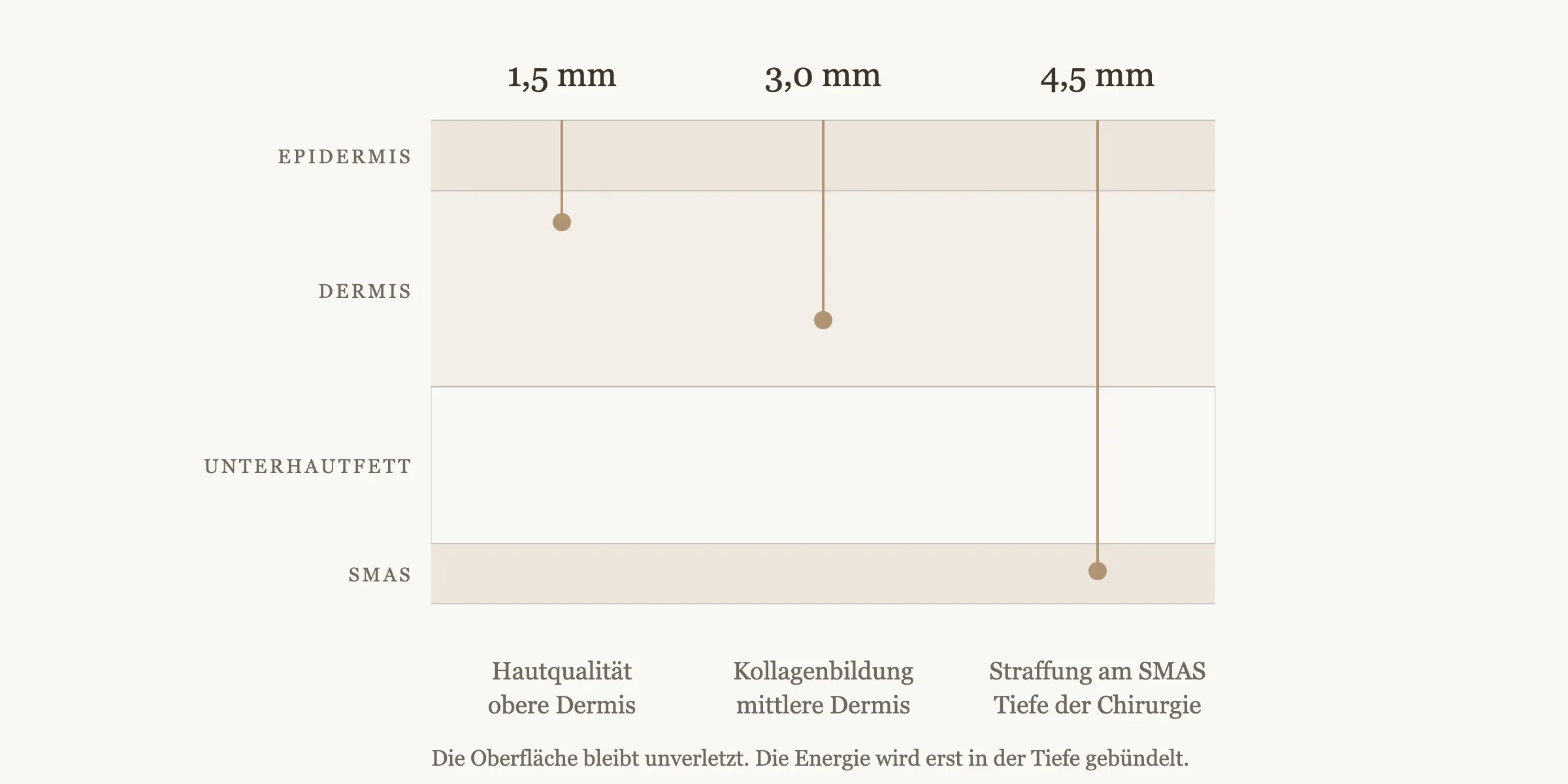 Ultherapy PRIME Berlin: Der Leitfaden | The Retreat 2 Querschnitt der Haut mit den drei Behandlungstiefen 1,5 mm, 3,0 mm und 4,5 mm