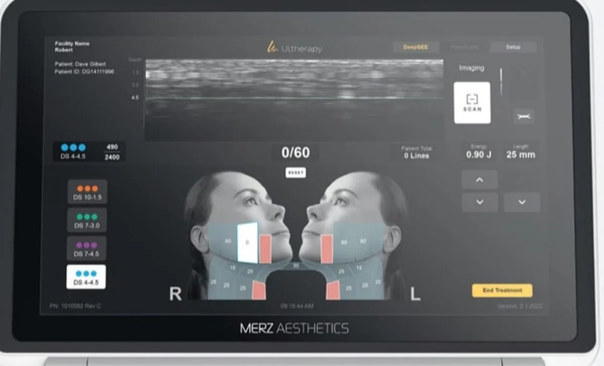 Der Bildschirm des Ultherapy-PRIME-Geräts mit dem Ultraschallbild der Hautschichten in Echtzeit und der Tiefenskala 1,5, 3,0 und 4,5 Millimeter