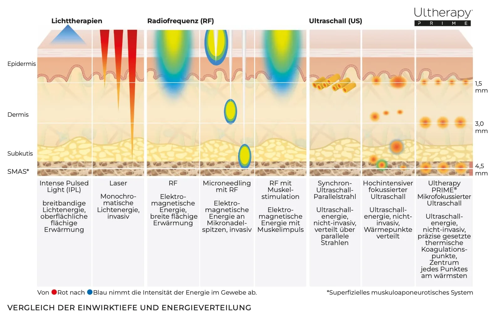 Ultherapy PRIME® DE 5 Übersicht des Herstellers zur Einwirktiefe und Energieverteilung von acht Verfahren im Hautquerschnitt
